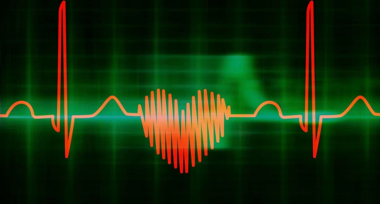 zachycardia